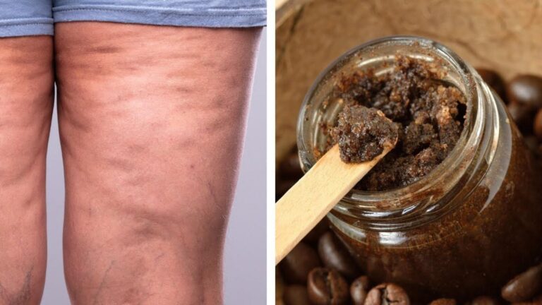 Questo semplice gesto con il caffè elimina cellulite e smagliature… scopri come farlo!