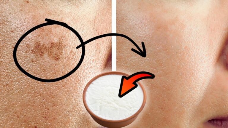 Questo semplice gesto naturale elimina le macchie dell’età… scopri come farlo facilmente!