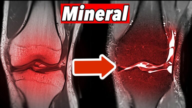 Scopri 5 segnali che indicano un deficit di questo minerale e come rimediare!