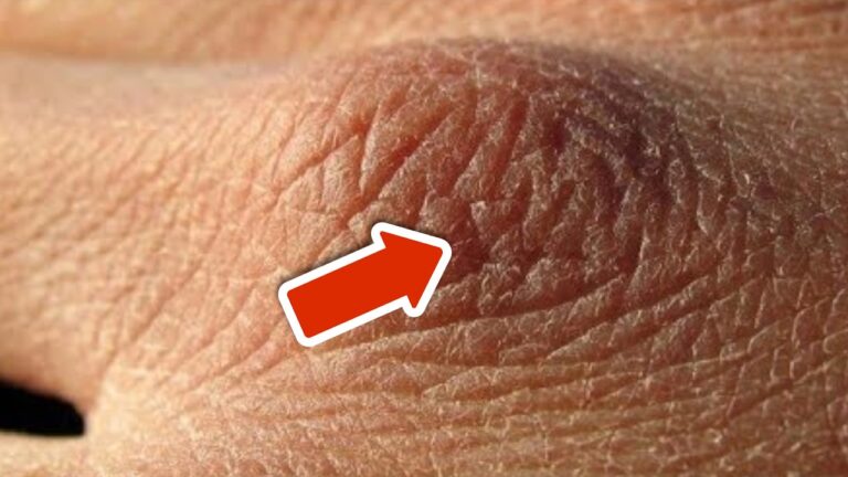 7 segni che indichano che bevi troppo poco acqua per la tua salute