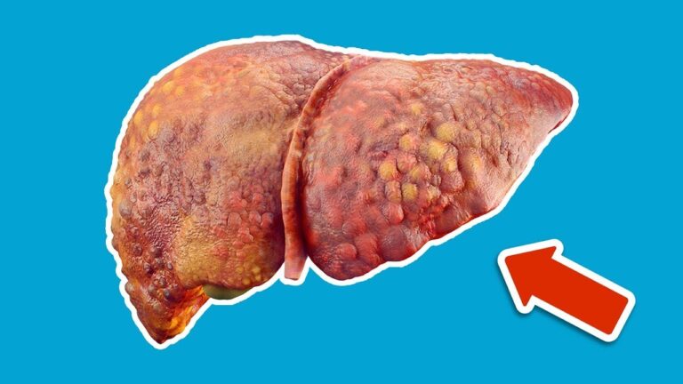 Scopri 1 tè che può curare la tua leber in 30 giorni!
