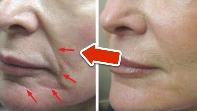 Scopri 5 sorprendenti rimedi naturali per un viso giovane e radioso!
