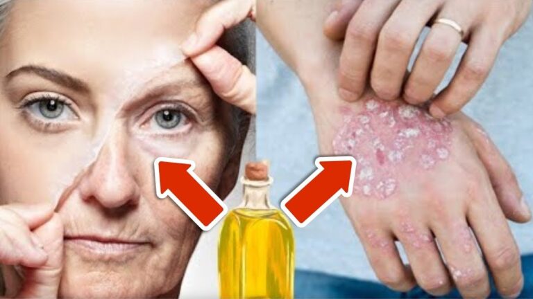 Elimina 5 anni di rughe con questo olio miracoloso! Scopri come usarlo!