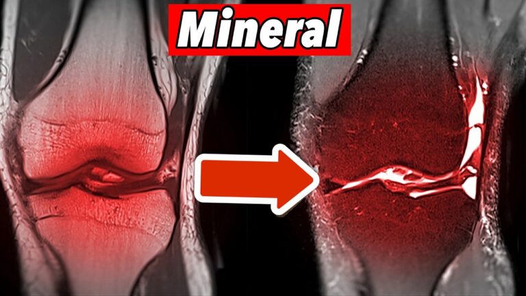 Scopri il minerale essenziale per proteggere il tuo ginocchio in 3 semplici passi!